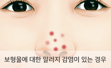 보형물에 대한 알러지 감염이 있는 경우