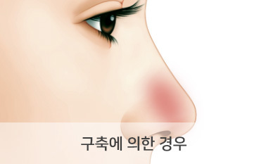 구축에 의한 경우
