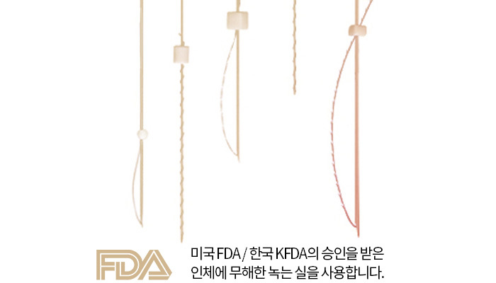미국FDA/ 한국FDA의 승인을 받은 인체에 무해한 녹는 실을 사용합니다.