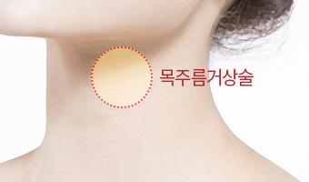 목주름거상술
