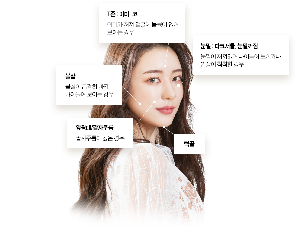 풀페이스 지방이식 시술부위 T존:이마-코 이마가 꺼져 얼굴에 볼륨이 없어 보이는 경우 볼살 볼살이 급격히 빠져 나이들어 보이는 경우 앞광대/팔자주름 팔자주름이 깊은 경우 눈밑:다크서클 눈밑꺼짐 눈밑이 거져있어 나이들어 보이거나 인상이 칙칙한 경우 턱끝
